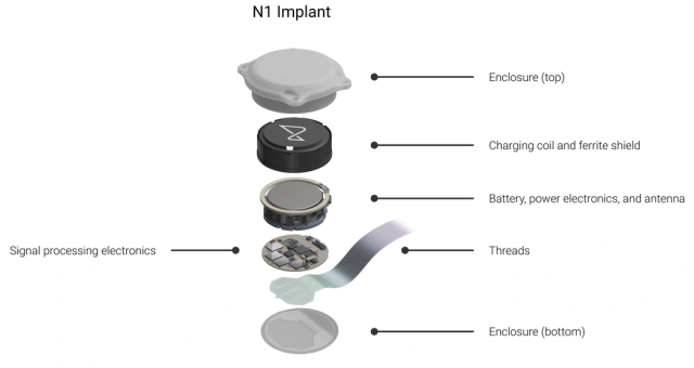 A Neuralink implantátuma  